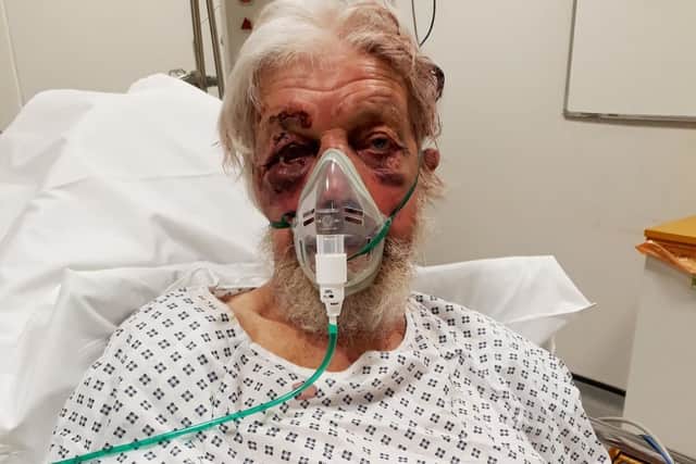 The 80-year-old pensioner suffered multiple injuries, including a broken wrist, nose and cheekbone. Picture: Metropolitan Police/PA Wire