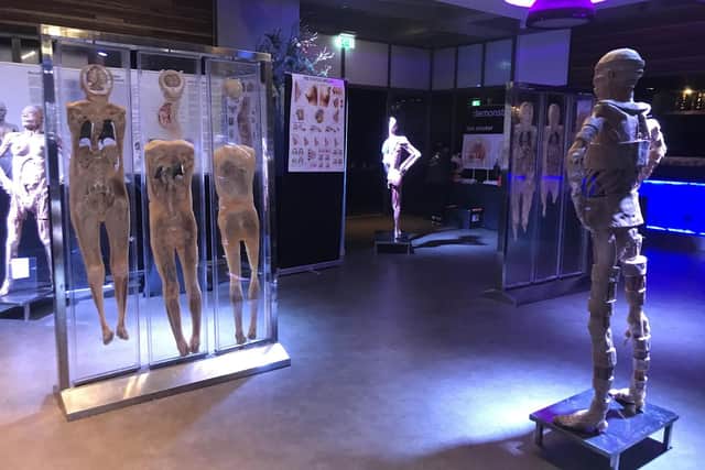 Some of the exhibits in the Real Human Bodies show, which is now not coming to Portsmouth Picture: Real Human Bodies Exhibition