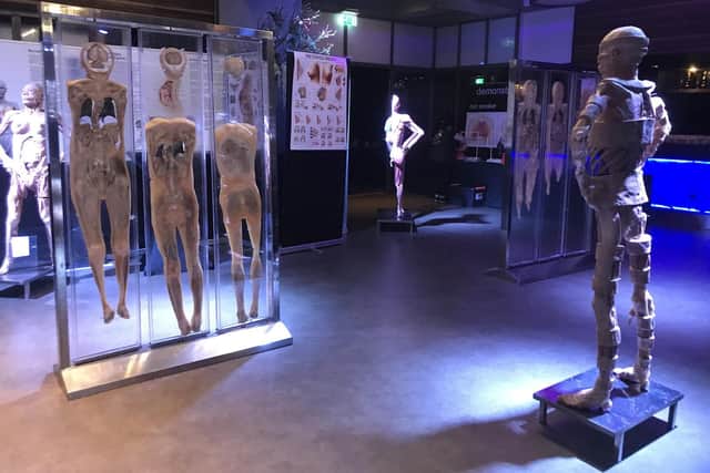 An image sent to The News by the Real Human Bodies organisers