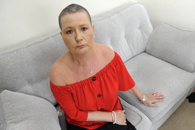 Maggie Smithson from Fareham. Burglars have broken into their home and stolen her new car which was a gift following chemotherapy for cancer. Picture: Ian Hargreaves  (010719-4)