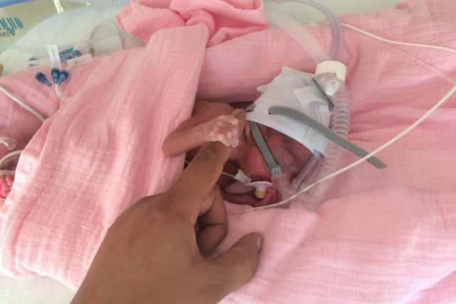 Poppy Bull spent the first nine months of her life in hospital. Picture: Vincent Bull