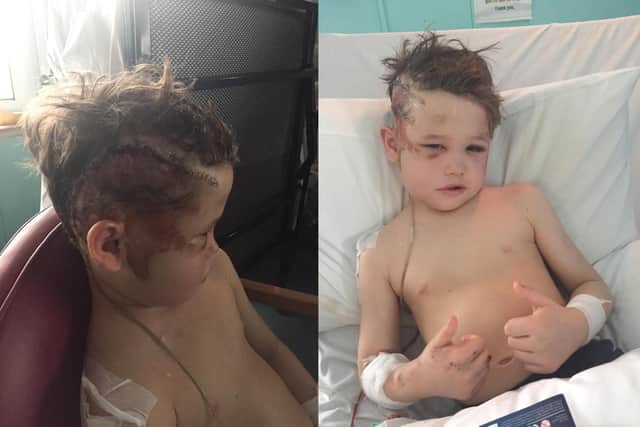 Willoughby Copeland recovering in hospital