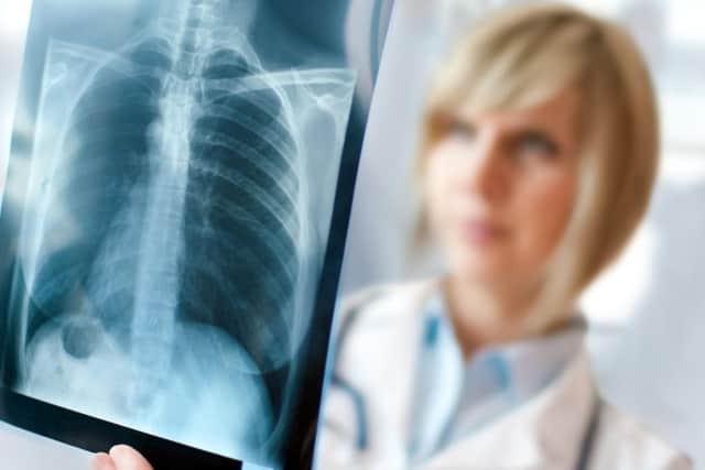 QA Hospital has been criticised in a report after thousands of patents did not have chest X-rays reviewed by an expertly-trained clinician
