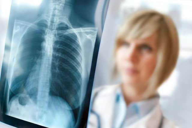 QA Hospital has been criticised in a report after thousands of patents did not have chest X-rays reviewed by an expertly-trained clinician