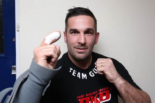 Mickey Parker fought at the O2 just 72 hours after chopping off the tip of his right index finger. Picture: Habibur Rahman