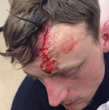 Arron Warren's injury after being struck