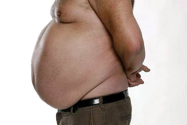 Pic for Lynn News Obese report ENGANL00120140502113522