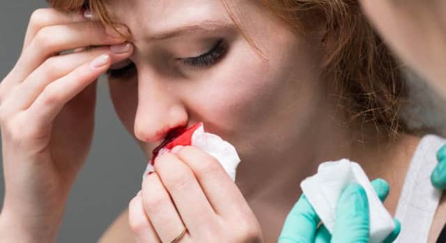 St John Ambulance gives advice on how to deal with nose bleeds