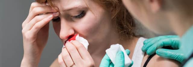 St John Ambulance gives advice on how to deal with nose bleeds