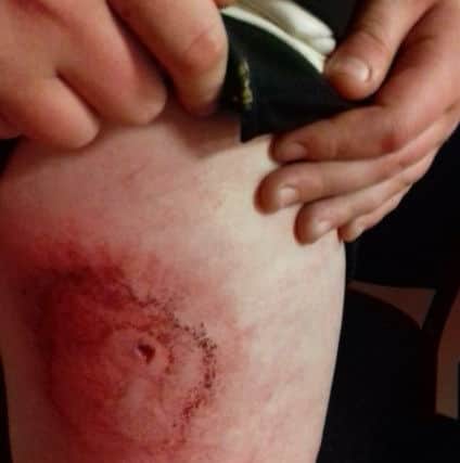 The stab wound in 10-year-old Landen Holt's leg Picture: Kerry Holt