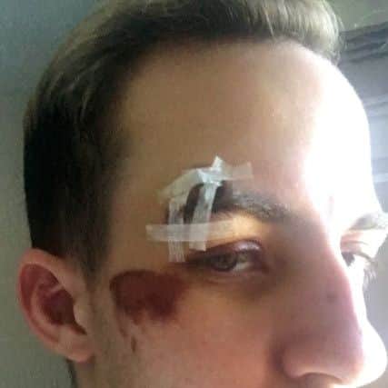 Jason Love, who was attacked in Portsmouth