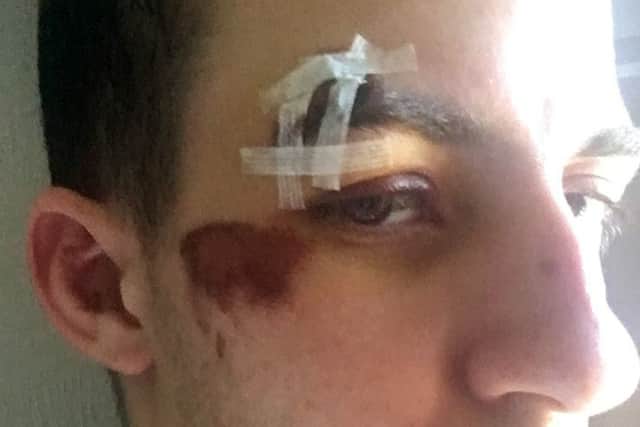 Jason Love, who was attacked in Portsmouth