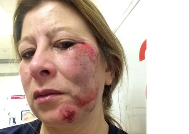 Pauline Lympany of Cosham came off her bike on the A27 in Portchester on Sunday, June 10, 2018
. 
She is warning others to wear a helmet