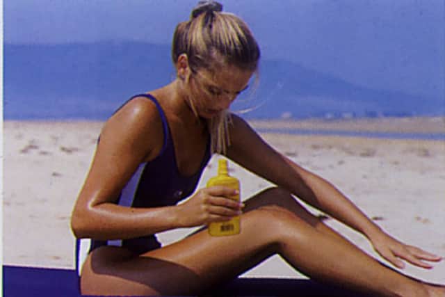 Tea bags, milk and yogurt are just some of the remedies said to treat sunburn