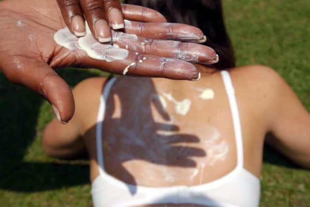 Sunburn can lead to more serious health issues later in life. Picture: Myung Jung Kim/PA Wire