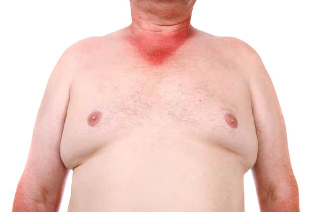 Blaise has had enough of the amount of fat male flesh on display...