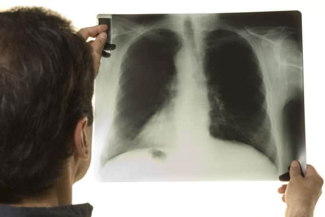 CQC had published its review on radiology reporting