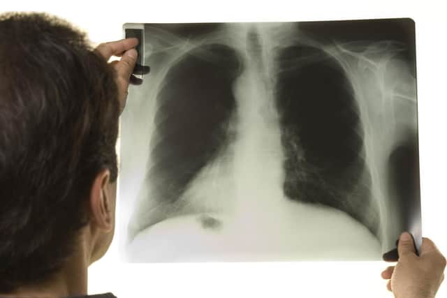 CQC has published its review on radiology reporting