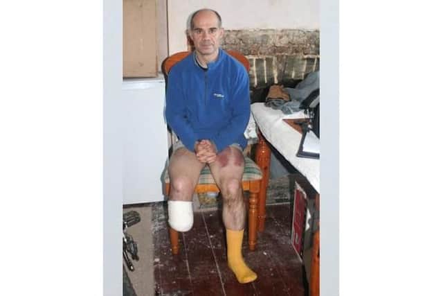 Rusty Brown, who had to have a leg amputated after an accident on the A259 near Bognor in 2017. The man whose car crashed into him, Kevin Zhou, has been jailed for three years

Picture: Sussex Police