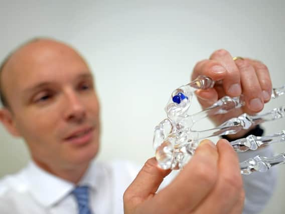 Surgeon Philip Sauve with a model of the hand showing the implant in blue. Picture: Malcolm Wells