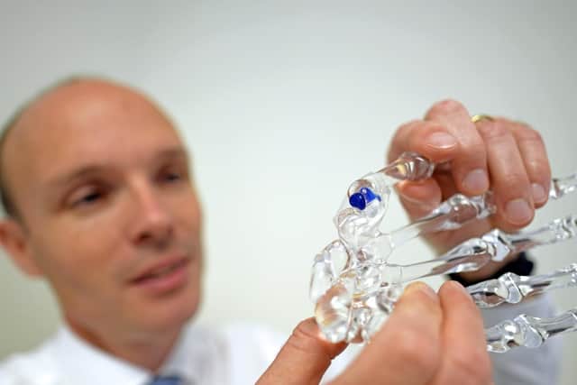 Surgeon Philip Sauve with a model of the hand showing the implant in blue. Picture: Malcolm Wells