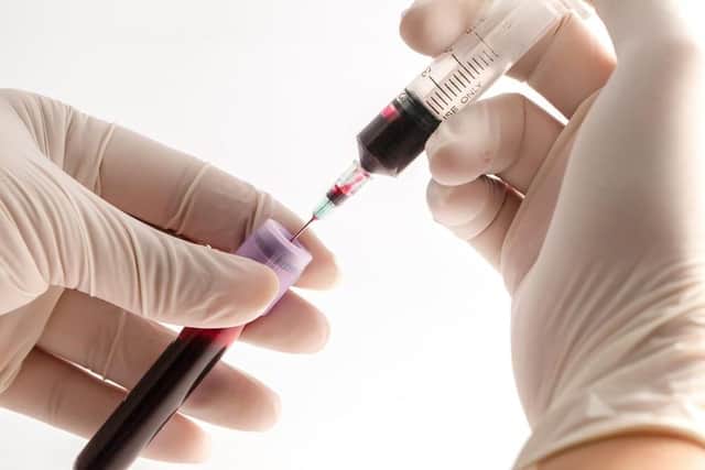 Rules on blood tests have been changed in Fareham, Gosport and Havant