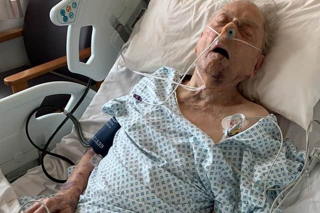 Peter Gouldstone is fighting for his life. Picture: Metropolitan Police/ PA Wire