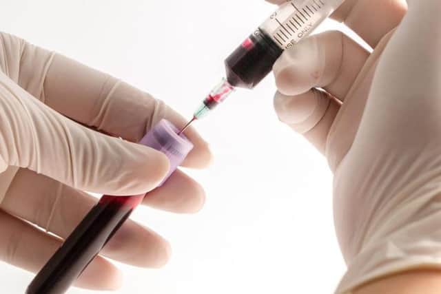 People fear having HIV