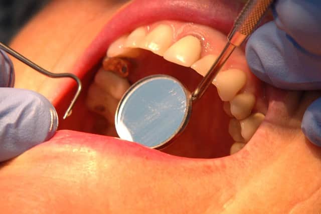 Concerns continue over Portsmouth's dental crisis. Photo: John Giles/PA Wire