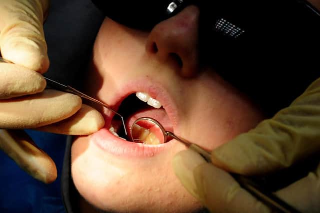 Around 20,000 patients were left without an NHS dentist when Colosseum Dental closed its surgeries in July this year