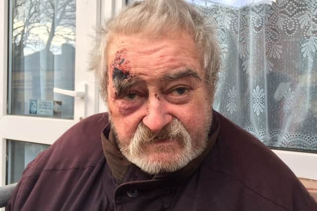 Edward Keane - who was left waiting more almost four hours for an ambulance after falling over in PortsmouthPicture: Tom Cotterill