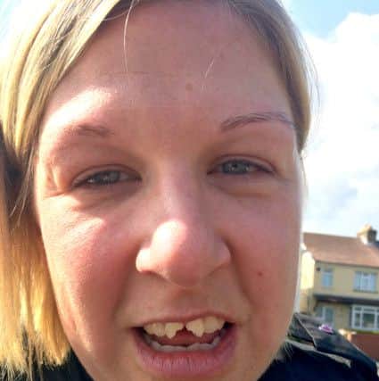 PC Steph Wheeler was hit in the face with handcuffs, injuring her teeth