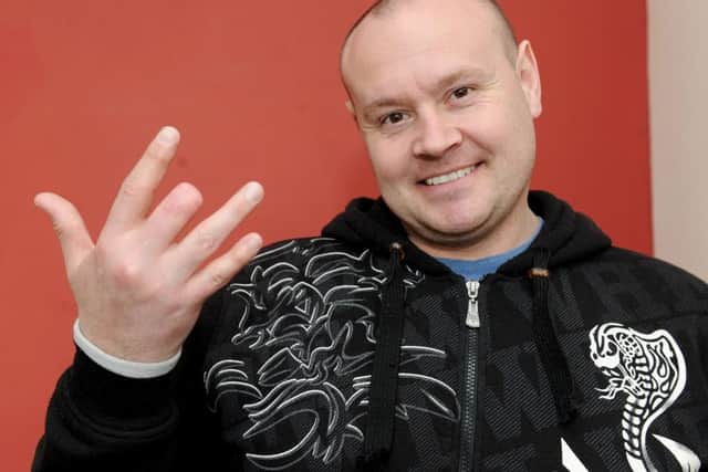 David Morgan lost part of his finger in an accident with a lathe