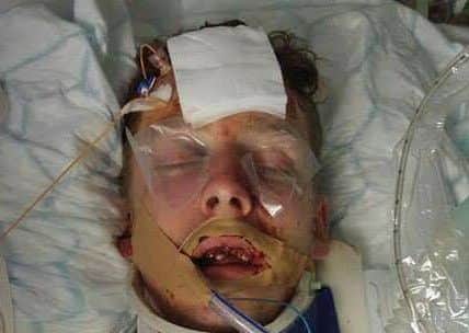 Mikey Ford in hospital