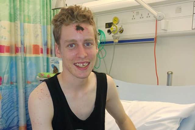 Mikey Ford, bruised and battered - but alive 
Picture courtesy of Mikey's dad, Darren
