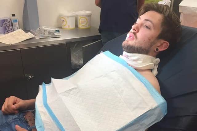 Owen Scrivens, 19, from Felpham, had his throat slit by a shard of glass when a biker smashed off his wing mirror in a suspected road rage incident. He is pictured receiving treatment at St Richard's Hospital, Chichester. KYl6MKacYLH0peyw9UUb