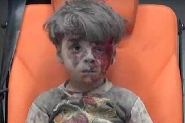 Omran Daqneesh, five, who was injured in a Syrian air strike