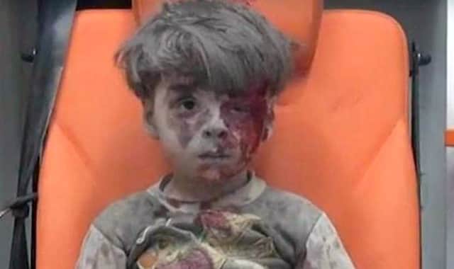 Omran Daqneesh, five, who was injured in a Syrian air strike