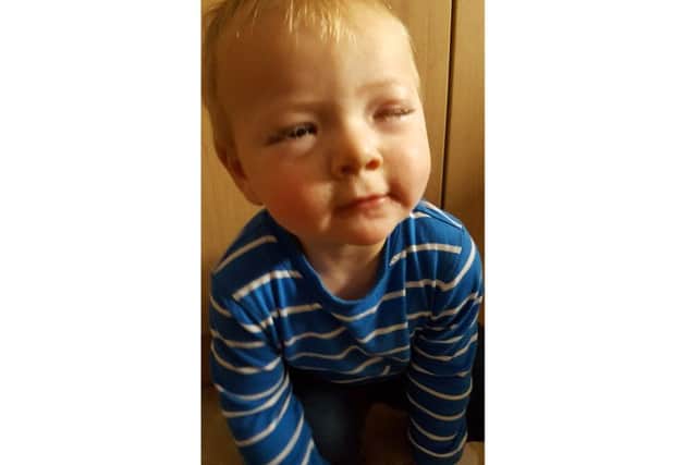 Alicia Theakston's son 16-month-old son Jesse was suffering from conjunctivitis