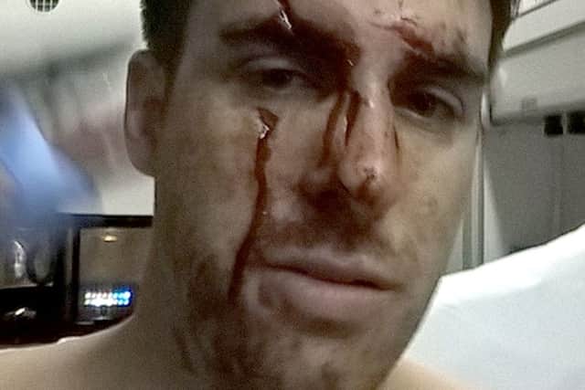 Ashley Donald after he was glassed in the face at Bar 38 in Gunwharf Quays.