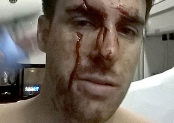 Ashley Donald after he was glassed in the face at Bar 38 in Gunwharf Quays.