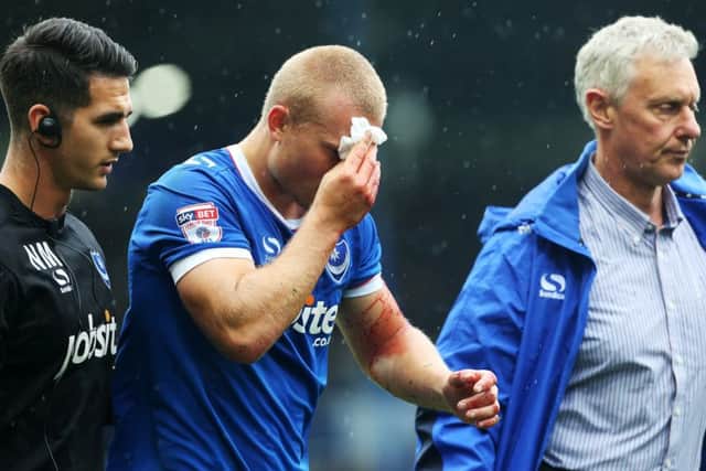 Curtis Davies comes off the pitch for treatment after a clash of heads against Wycombe on Saturday Picture: Joe Pepler