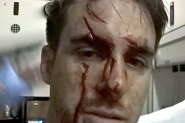 Ashley Donald after he was glassed in the face at Bar 38 in Gunwharf Quays. PPP-150629-174308001