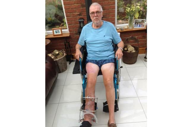 Cyclist Phil Dyke from Gosport who was injured after being hit by a car