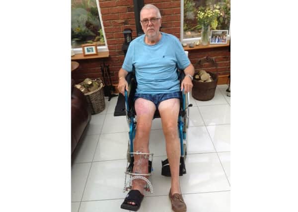 Cyclist Phil Dyke from Gosport who was injured after being hit by a car