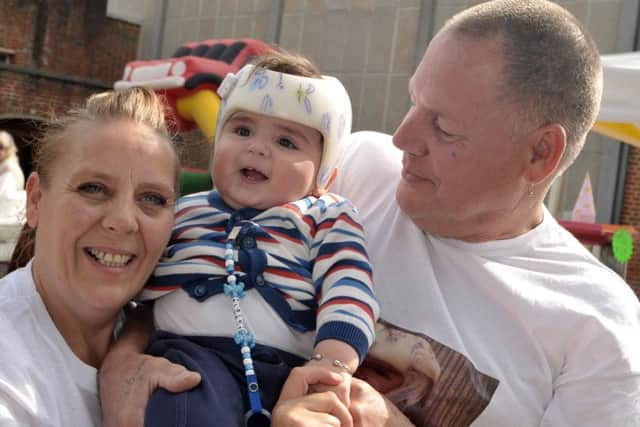 Dee Treadwell and Stephen Hider with baby Albert Treadwell, who needs a corrective helmet for his skull condition Picture: Mick Young (161154-02)