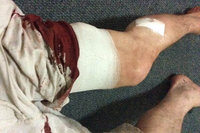 Phil Hewitt after being stabbed in Cape Town
