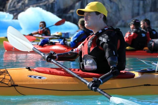 Alex Lewis recently triumphed in the face of adversity after losing four limbs in 2013. Picture: The Alex Lewis Trust.