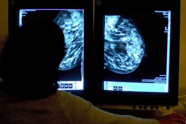 A consultant studying a mammogram