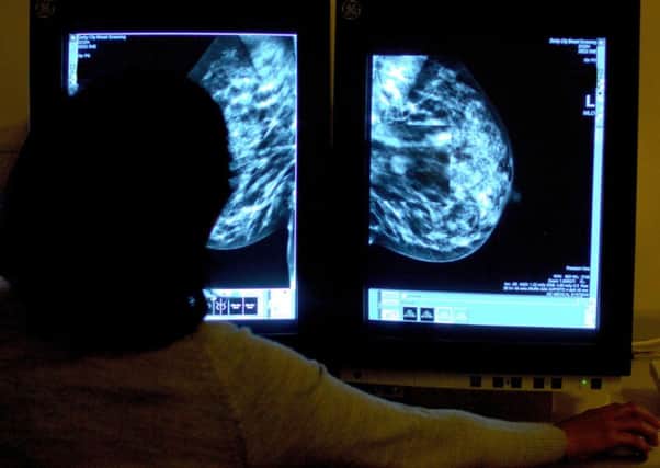 A consultant studying a mammogram